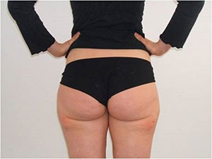 aqualyx po aqualyx po