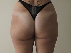 aqualyx po aqualyx po