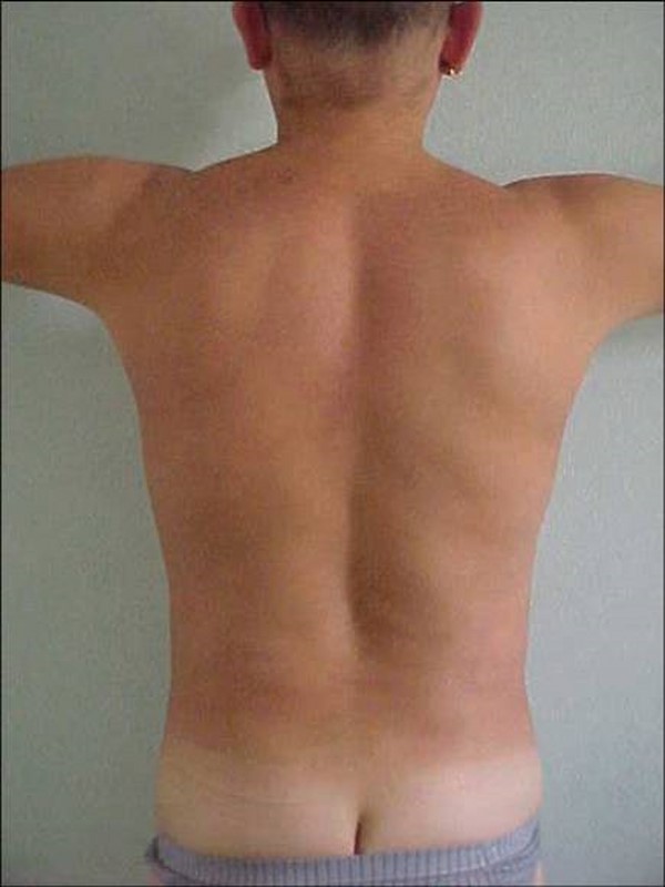 aqualyx po aqualyx po